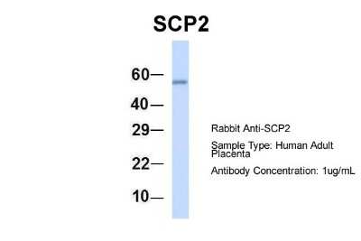 Western Blot: Sterol carrier protein 2 Antibody [NBP1-55214]