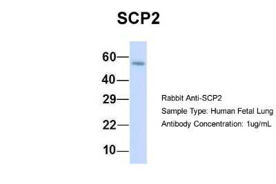 Western Blot: Sterol carrier protein 2 Antibody [NBP1-55214]
