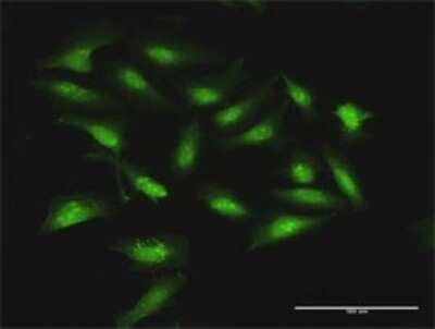Immunocytochemistry/ Immunofluorescence: Stomatin Antibody [H00002040-D01P]