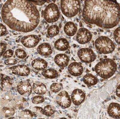 Immunohistochemistry-Paraffin: Stomatin Antibody [NBP1-88562]