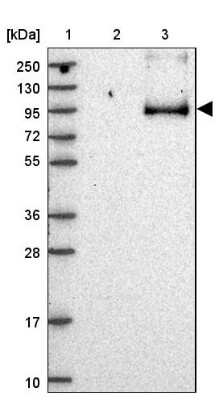 Western Blot: Storkhead Box 2 Antibody [NBP2-30480]