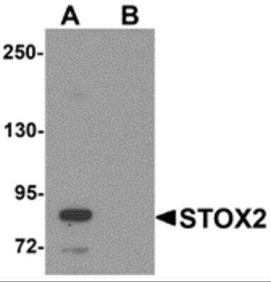 Western Blot: Storkhead Box 2 AntibodyBSA Free [NBP2-81978]