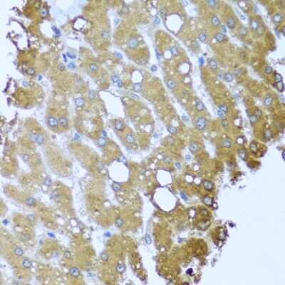 Immunohistochemistry-Paraffin: Striatin Antibody - BSA Free [NBP2-93410]