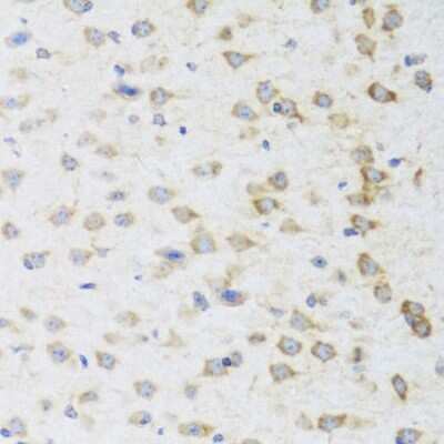 Immunohistochemistry-Paraffin: Striatin Antibody - BSA Free [NBP2-93410]
