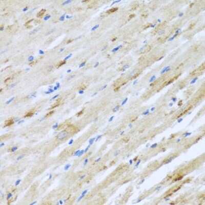 Immunohistochemistry-Paraffin: Striatin Antibody - BSA Free [NBP2-93410]