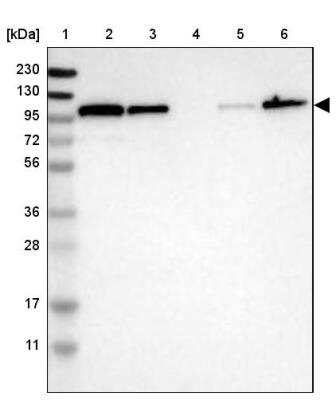 Western Blot: Striatin Antibody [NBP1-80762]