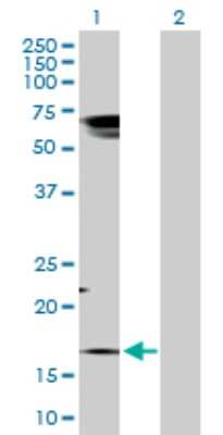 Western Blot: Preprotachykinin-1 Antibody [H00006863-D01P]