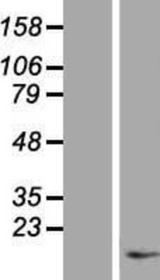 Western Blot: Preprotachykinin-1 Overexpression Lysate [NBP2-10336]