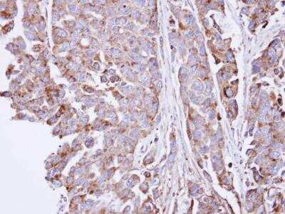 Immunohistochemistry-Paraffin: Sulfamidase/SGSH Antibody [NBP1-33071]