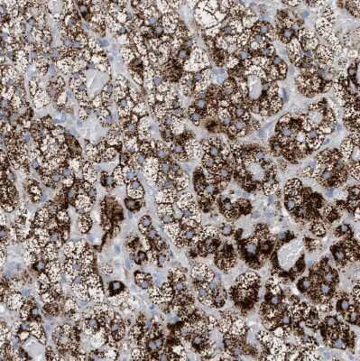 Immunohistochemistry-Paraffin: Sulfamidase/SGSH Antibody [NBP1-83164]