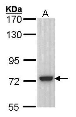 Western Blot: Sulfamidase/SGSH Antibody [NBP1-33071]