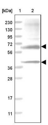 Western Blot: Sulfamidase/SGSH Antibody [NBP1-83164]