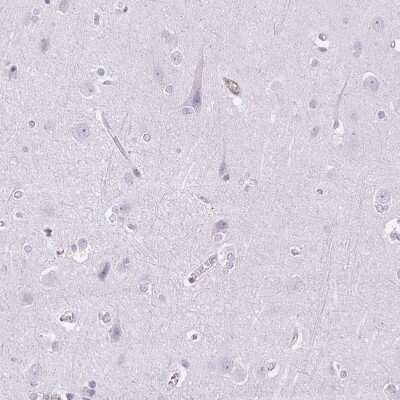 Immunohistochemistry-Paraffin: Sulfatase 1 Antibody [NBP2-31584]