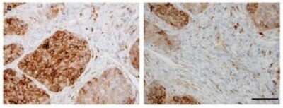 Immunohistochemistry: Sulfatase-2/SULF2 Antibody (2B4) - Azide and BSA Free [NBP2-80967]