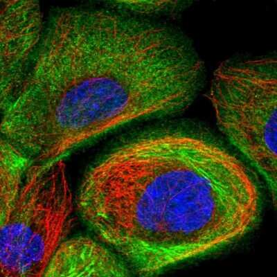 Immunocytochemistry/ Immunofluorescence: Supervillin Antibody [NBP1-90363]