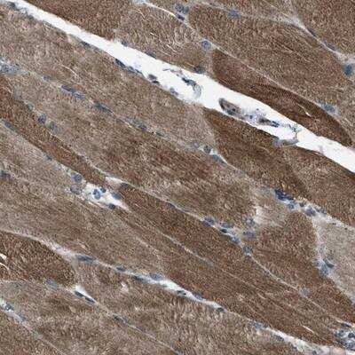 Immunohistochemistry: Supervillin Antibody [NBP1-87559]