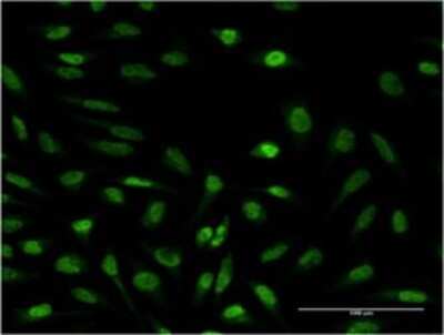 Immunocytochemistry/ Immunofluorescence: Suppressor of Ty 4 homolog 1 Antibody (3G4) [H00006827-M01]