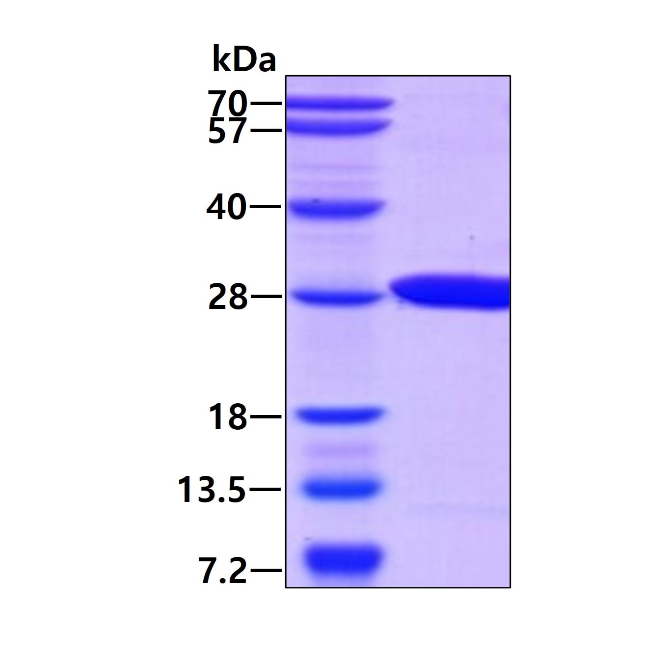 SDS-PAGE: Recombinant Human Surf1 His Protein [NBP1-30315]