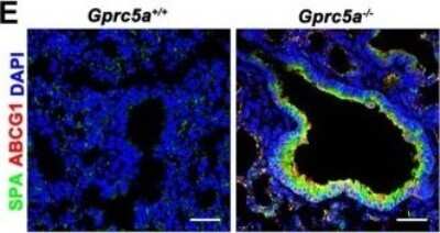 Immunocytochemistry/ Immunofluorescence: Surfactant Protein A Antibody [NBP2-12928]