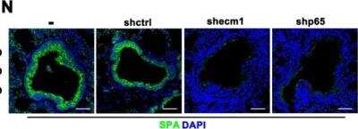 Immunocytochemistry/ Immunofluorescence: Surfactant Protein A Antibody [NBP2-12928]