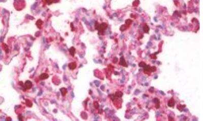 Immunohistochemistry-Paraffin: Surfactant Protein A Antibody [NBP2-12928]
