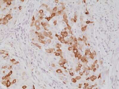 Immunohistochemistry: Surfactant Protein A Antibody (RM334) [NBP2-77414]