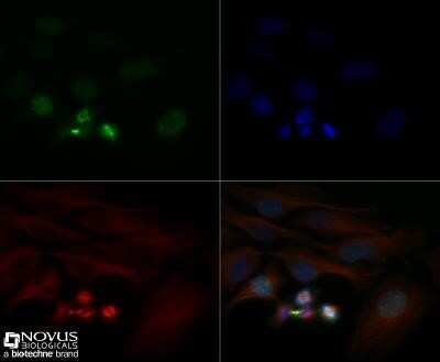 Immunocytochemistry/ Immunofluorescence: Survivin Antibody (1277A) - Azide and BSA Free [NBP2-80971]