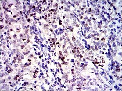 Immunohistochemistry-Paraffin: Survivin Antibody (1H5) - BSA Free [NBP2-22188]
