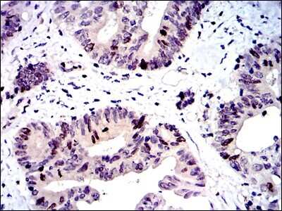 Immunohistochemistry-Paraffin: Survivin Antibody (1H5) - BSA Free [NBP2-22188]