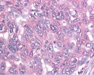 Immunohistochemistry-Paraffin: Survivin Antibody (60.11) - BSA Free [NB500-238]