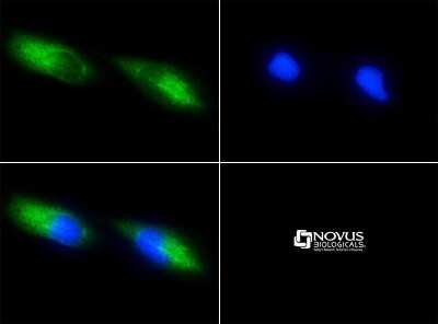 Immunocytochemistry/ Immunofluorescence: Survivin Antibody (8E2) - Azide and BSA Free [NBP2-80970]