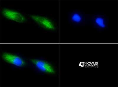 Immunocytochemistry/ Immunofluorescence: Survivin Antibody (8E2) [NB500-644]