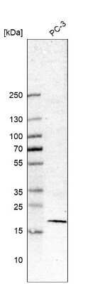 Western Blot: Survivin Antibody (CL12064) [NBP3-18538]