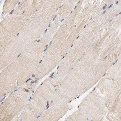 Immunohistochemistry-Paraffin: Survivin Antibody [NBP2-48494]