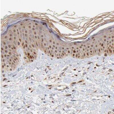 Immunohistochemistry-Paraffin: Survivin Antibody [NBP2-48494]