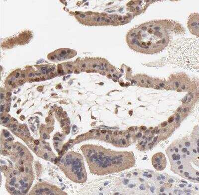 Immunohistochemistry-Paraffin: Survivin Antibody [NBP2-48494]