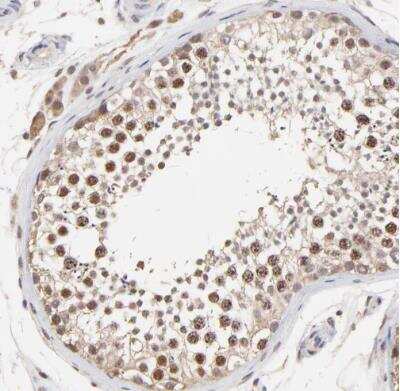 Immunohistochemistry-Paraffin: Survivin Antibody [NBP2-48494]