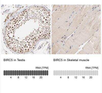 Immunohistochemistry-Paraffin: Survivin Antibody [NBP2-48494]