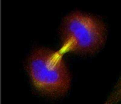 Immunocytochemistry/ Immunofluorescence: Survivin Antibody Pack [NB100-911]
