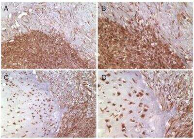 Immunohistochemistry: Survivin Antibody Pack [NB100-911]