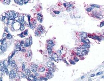 Immunohistochemistry-Paraffin: Survivin Antibody Pack [NB100-911]