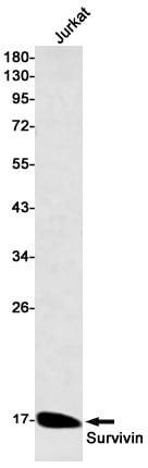Western Blot: Survivin Antibody (S04-1B1) [NBP3-20088]