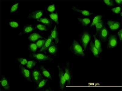 Immunocytochemistry/ Immunofluorescence: Symplekin Antibody (4C2) [H00008189-M03]