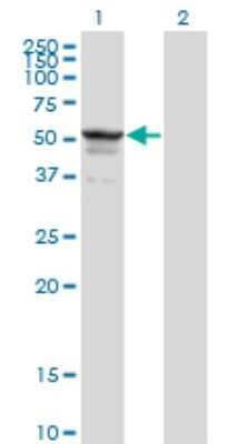 Western Blot: Symplekin Antibody (4C2) [H00008189-M03]