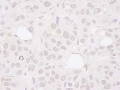 Immunohistochemistry: Symplekin Antibody [NB100-74590]