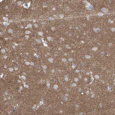 Immunohistochemistry: Synapsin 3 Antibody [NBP1-87519]