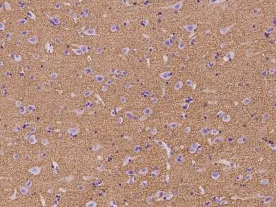 Immunohistochemistry-Paraffin: Synapsin 3 Antibody [NBP2-98603]