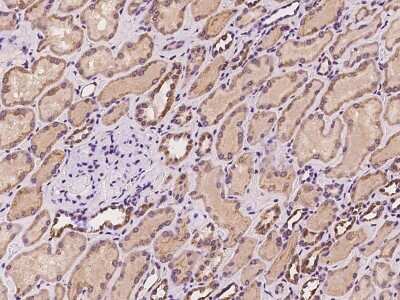 Immunohistochemistry-Paraffin: Synapsin 3 Antibody [NBP2-98603]