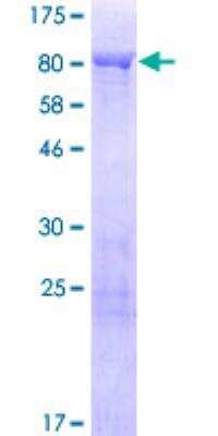 SDS-PAGE: Recombinant Human Synapsin 3 GST (N-Term) Protein [H00008224-P01]