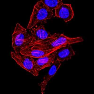 Immunocytochemistry/ Immunofluorescence: Synapsin I Antibody (7H10G6) - BSA Free [NBP2-61895]